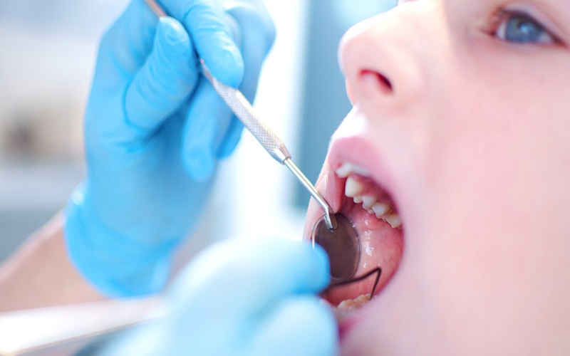 Dealing With Tooth Loss: A General Dentist’s Perspective