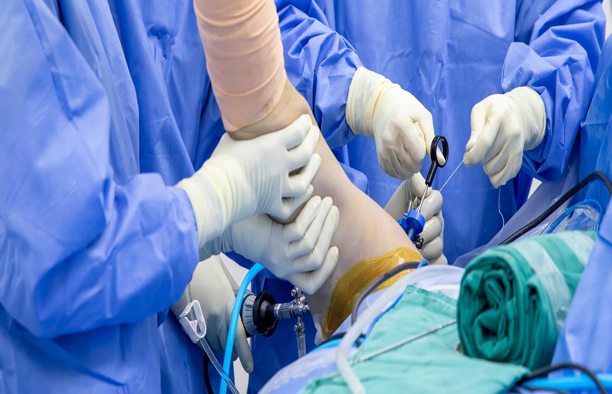 Orthopedic Surgeons In Advancements Of Arthroscopy