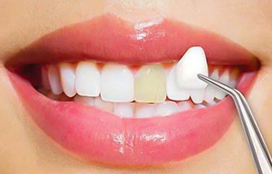 Cosmetic Dentistry