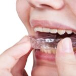 Invisalign in Weston, MA,