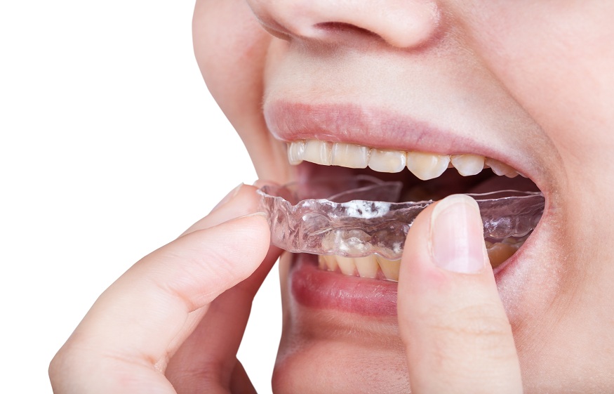 Invisalign in Weston, MA,